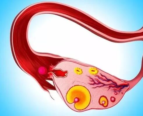 输卵管过长有什么症状？输卵管过长会影响受孕吗？